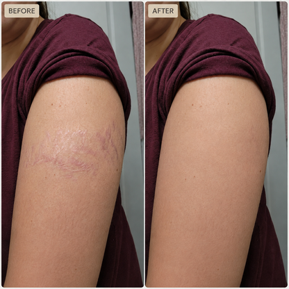 Retinal Skin Booster